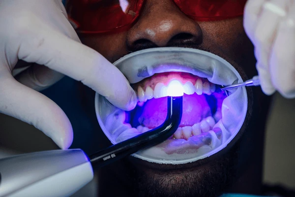 teeth whitening near you