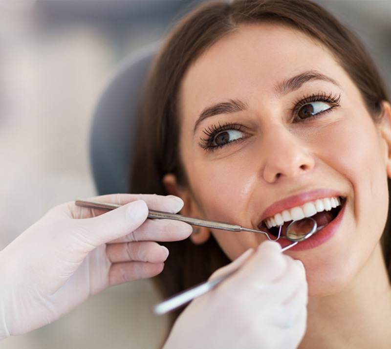 Dental Inlays and Dental Onlays in Vancouver
