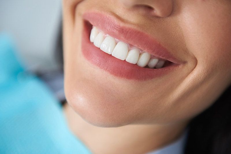 teeth whitening in vancouver